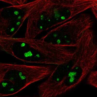 Immunocytochemistry/ Immunofluorescence: ZNF483 Antibody [NBP2-31592]