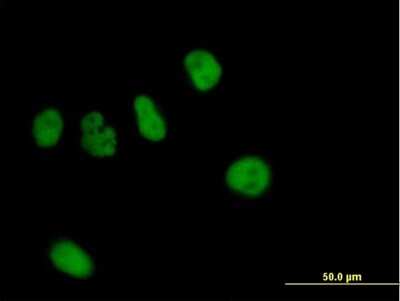 Immunocytochemistry/ Immunofluorescence: ZNF484 Antibody [H00083744-B01P]
