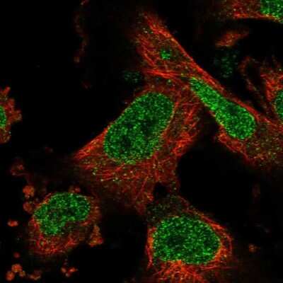 Immunocytochemistry/ Immunofluorescence: ZNF484 Antibody [NBP1-88750]