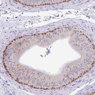 Immunohistochemistry-Paraffin: ZNF485 Antibody [NBP2-32451]