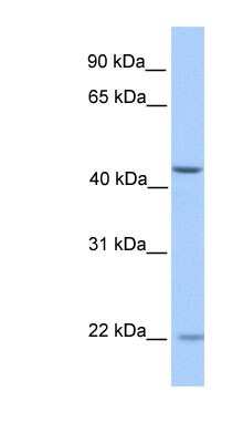 Western Blot: ZNF485 Antibody [NBP1-80399]