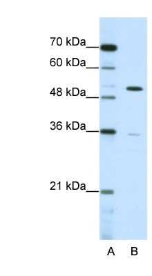 Western Blot: ZNF485 Antibody [NBP1-80400]