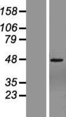 Western Blot: ZNF485 Overexpression Lysate [NBL1-18163]