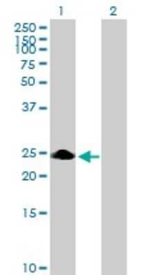 Western Blot: ZNF486 Antibody [H00090649-B01P]