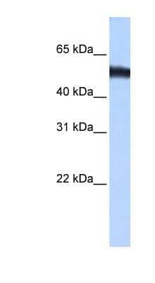 Western Blot: ZNF486 Antibody [NBP1-79462]