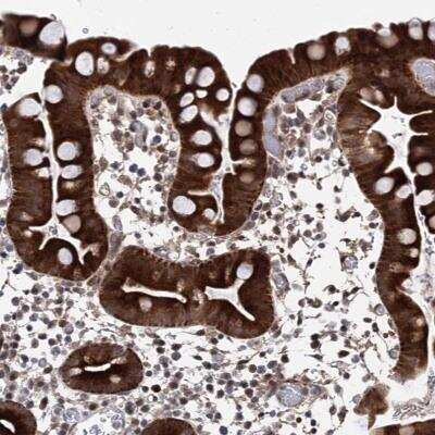 Immunohistochemistry-Paraffin: ZNF488 Antibody [NBP1-82006]