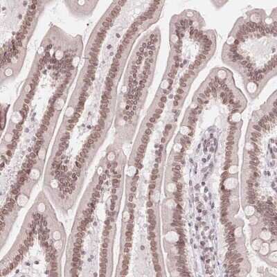 Immunohistochemistry-Paraffin: ZNF488 Antibody [NBP2-48819]