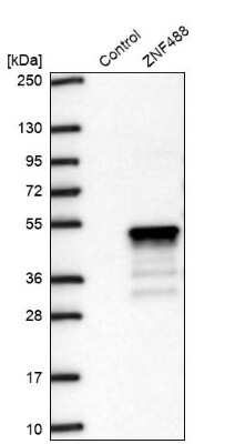 Western Blot: ZNF488 Antibody [NBP2-48819]