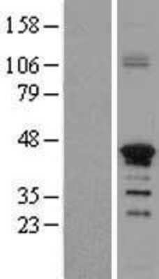 Western Blot: ZNF488 Overexpression Lysate [NBL1-18164]