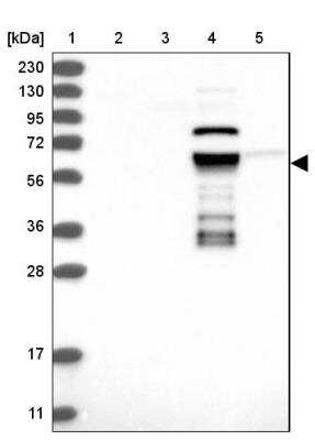 Western Blot: ZNF490 Antibody [NBP1-81432]