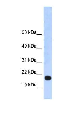 Western Blot: ZNF493 Antibody [NBP1-91547]