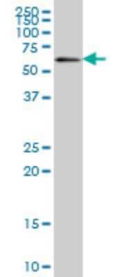 Western Blot: ZNF496 Antibody (2B3) [H00084838-M08]