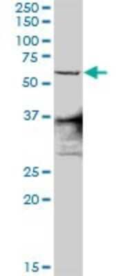 Western Blot: ZNF496 Antibody [H00084838-D01P]