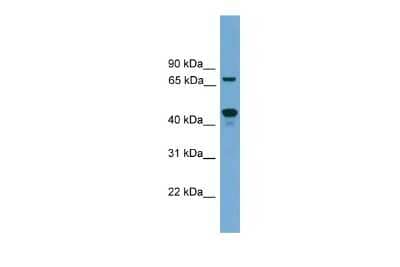 Western Blot: ZNF496 Antibody [NBP3-10442]