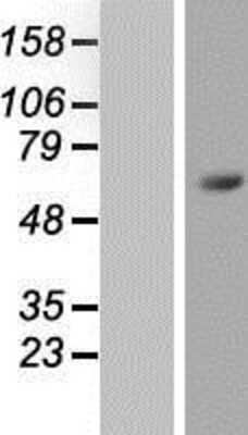 Western Blot: ZNF496 Overexpression Lysate [NBP2-05975]