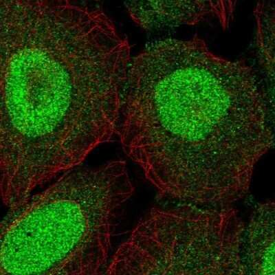 Immunocytochemistry/ Immunofluorescence: ZNF497 Antibody [NBP2-13576]