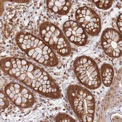 Immunohistochemistry-Paraffin: ZNF497 Antibody [NBP2-13576]