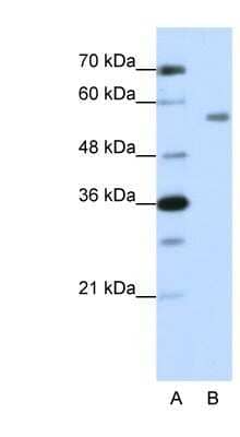 Western Blot: ZNF497 Antibody [NBP1-80438]