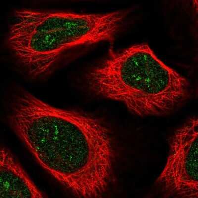 Immunocytochemistry/ Immunofluorescence: ZNF498 Antibody [NBP2-33738]