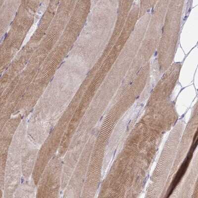 Immunohistochemistry: ZNF498 Antibody [NBP2-33818]