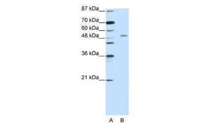 Western Blot: ZNF498 Antibody [NBP2-86506]