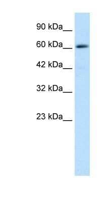 Western Blot: ZNF499 Antibody [NBP1-79965]