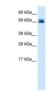 Western Blot: ZNF499 Antibody [NBP1-79966]