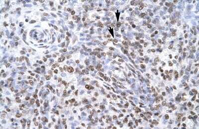 Immunohistochemistry: ZNF500 Antibody [NBP2-88697]