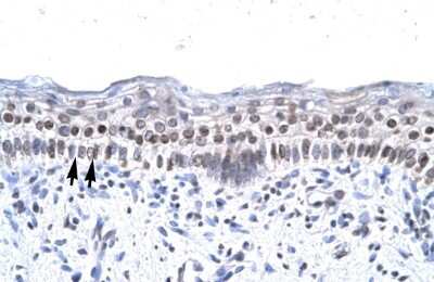 Immunohistochemistry: ZNF500 Antibody [NBP2-88697]