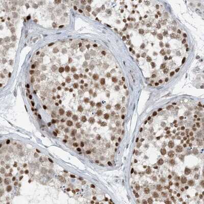 Immunohistochemistry-Paraffin: ZNF500 Antibody [NBP1-81502]