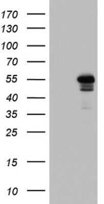 Western Blot: ZNF500 Antibody (OTI2D2)Azide and BSA Free [NBP2-74953]