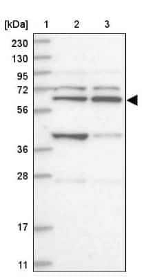 Western Blot: ZNF500 Antibody [NBP1-81502]