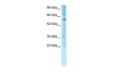 Western Blot: ZNF500 Antibody [NBP2-88697]