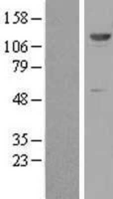 Western Blot: ZNF500 Overexpression Lysate [NBP2-06521]