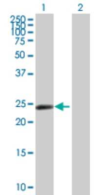 Western Blot: ZNF501 Antibody [H00115560-B01P]