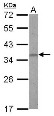 Western Blot: ZNF501 Antibody [NBP2-21020]