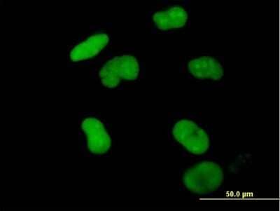 Immunocytochemistry/ Immunofluorescence: ZNF502 Antibody [H00091392-B01P]