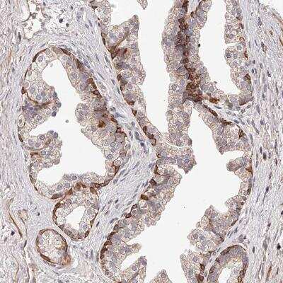 Immunohistochemistry-Paraffin: ZNF502 Antibody [NBP1-82298]