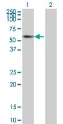 Western Blot: ZNF502 Antibody [H00091392-B01P]