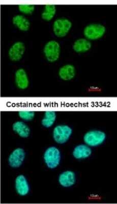 Immunocytochemistry/ Immunofluorescence: ZNF503 Antibody [NBP2-21021]