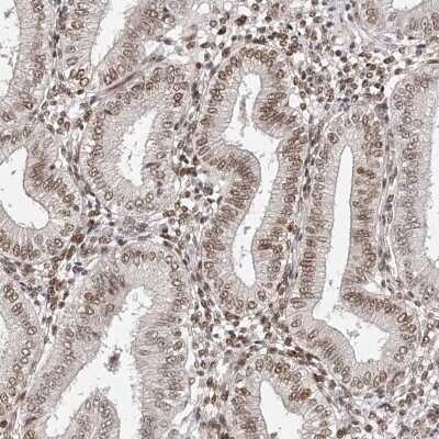 Immunohistochemistry-Paraffin: ZNF503 Antibody [NBP1-81889]