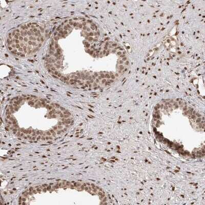Immunohistochemistry-Paraffin: ZNF503 Antibody [NBP1-81889]