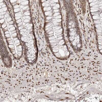 Immunohistochemistry-Paraffin: ZNF503 Antibody [NBP1-81889]