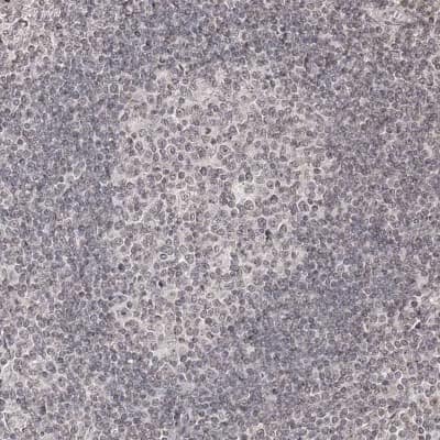 Immunohistochemistry-Paraffin: ZNF503 Antibody [NBP1-81889]