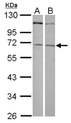 Western Blot: ZNF503 Antibody [NBP2-21021]