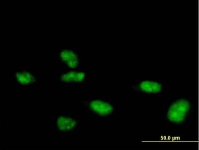 Immunocytochemistry/ Immunofluorescence: ZNF507 Antibody [H00022847-B01P]