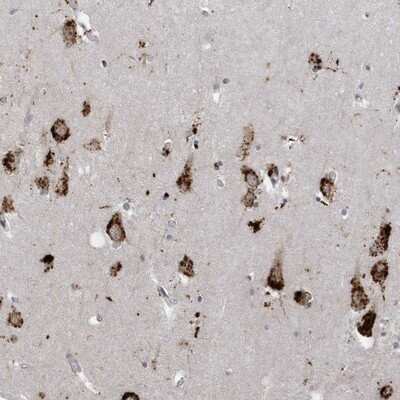 Immunohistochemistry-Paraffin: ZNF507 Antibody [NBP1-82932]