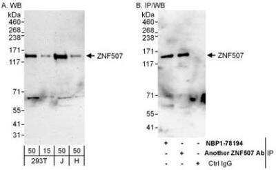 Western Blot: ZNF507 Antibody [NBP1-78194]