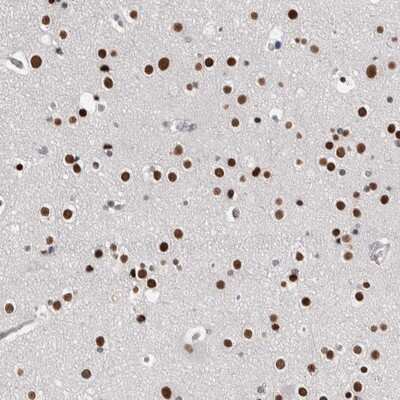 Immunohistochemistry-Paraffin: ZNF509 Antibody [NBP1-92628]