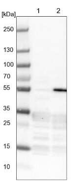 Western Blot: ZNF509 Antibody [NBP1-92628]